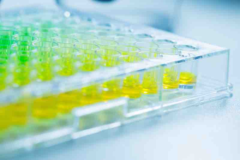 SPT Labtech and Cavendish combine technologies to improve the cell-based assay design process