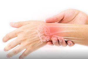 Studies reveal how shingles vaccine should be used in arthritis patients