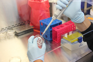 Syncona launches early-stage drug development company, Slingshot Therapeutics