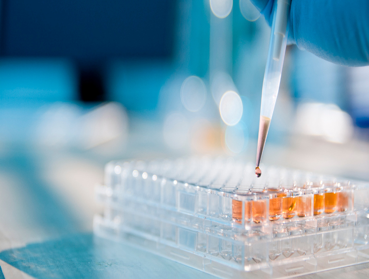 Tecan and UgenTec partner to offer sample-to-result solutions for qPCR