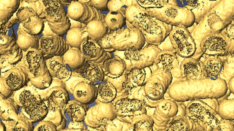 A 3D rendering shows dead bacteria and where it has been eaten by the nanozymes. Photo: Dr Chaitali Dekiwadia/ RMIT Microscopy and Microanalysis Facility