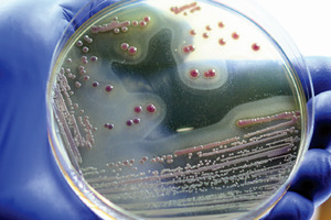 The rise of small molecule enzyme substrates in microbiology