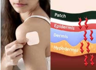 The vapour permeability of transdermal patches