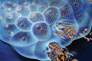 Transgene and Randox to develop innovative multifunctional oncolytic virotherapies for solid tumors