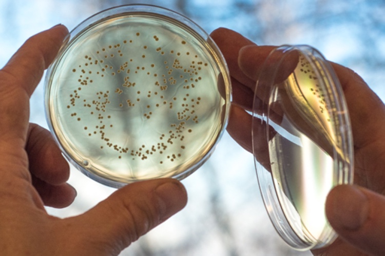 Treating chronic wounds with live biotherapeutics