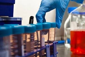 TxCell completes CAR-Treg manufacturing process development
