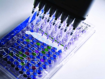 UK Biobank implements Nautilus LIMS by Thermo Electron