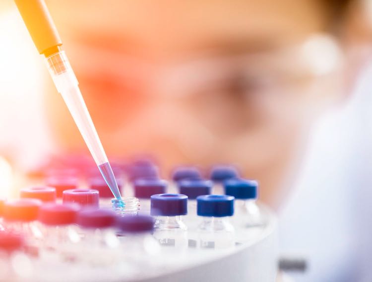 Univercells launches cell and gene therapy CDMO