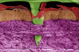 Vaxxas agrees Nanopatch collaboration with Merck