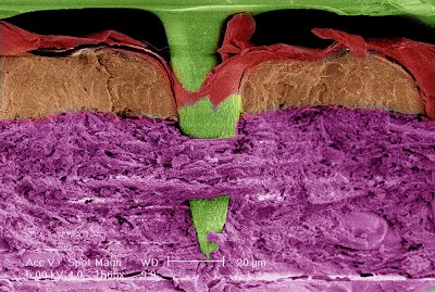 Vaxxas agrees Nanopatch collaboration with Merck