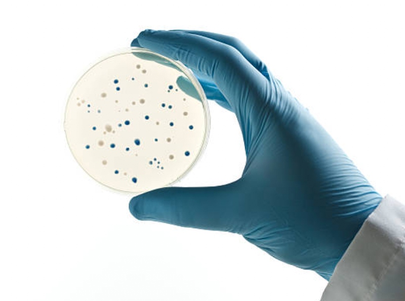 Plasmid and lentiviral vector CDMO VectorBuilder orders rise by 70%