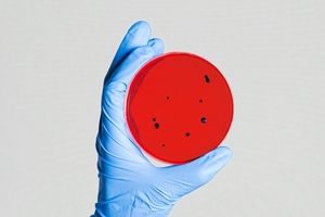 Vidac Pharma’s cancer drug candidate shows promising efficacy