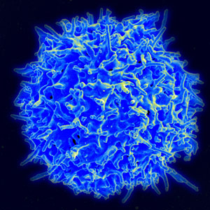 World-first gene therapy to target devastating rare immune disorder