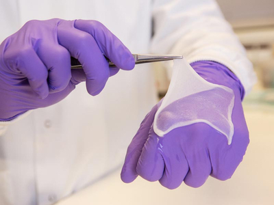 Wound care product supports healing without skin graft